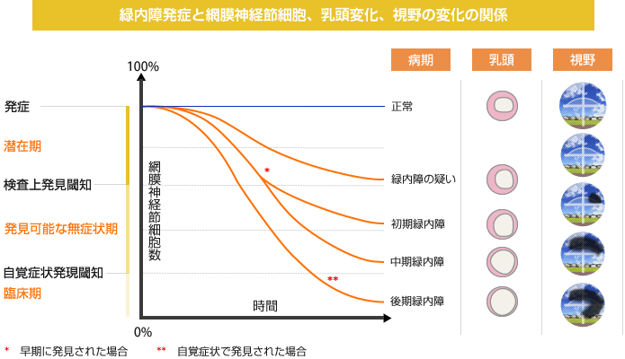 緑内障発症と網膜神経節細胞、乳頭変化、視野の変化の関係