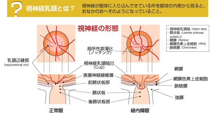 視神経乳頭とは？視神経が眼球に入り込んできている所を眼球の内側から見ると、おなかのおへそのようになっていること。